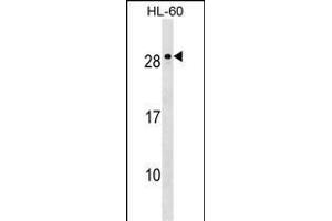 MED18 Antibody (C-term) (ABIN1536799 and ABIN2849776) western blot analysis in HL-60 cell line lysates (35 μg/lane). (MED18 抗体  (C-Term))