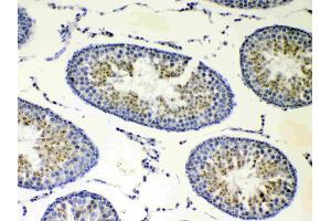 IHC analysis of CP110 using anti-CP110 antibody . (CP110 抗体  (AA 51-284))