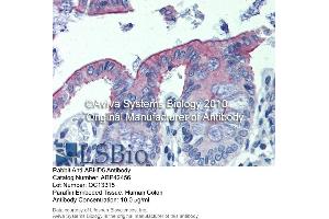 Immunohistochemistry (IHC) image for anti-Abhydrolase Domain Containing 5 (ABHD5) (C-Term) antibody (ABIN2775425) (ABHD5 抗体  (C-Term))