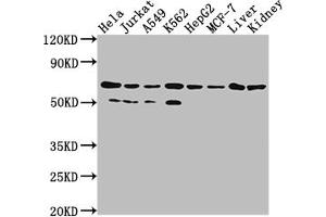 Western Blot Positive WB detected in: Hela whole cell lysate, Jurkat whole cell lysate, A549 whole cell lysate, HepG2 whole cell lysate, MCF-7 whole cell lysate, Rat liver tissue, Rat kidney tissue All lanes: AIFM1 antibody at 1:2000 Secondary Goat polyclonal to rabbit IgG at 1/50000 dilution Predicted band size: 67, 36, 29, 27 kDa Observed band size: 67 kDa (Recombinant AIF 抗体)