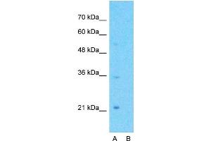 Host:  Rabbit  Target Name:  GPCR5A  Sample Type:  Jurkat  Lane A:  Primary Antibody  Lane B:  Primary Antibody + Blocking Peptide  Primary Antibody Concentration:  1ug/ml  Peptide Concentration:  5ug/ml  Lysate Quantity:  25ug/lane/lane  Gel Concentration:  0. (GPRC5A 抗体  (C-Term))