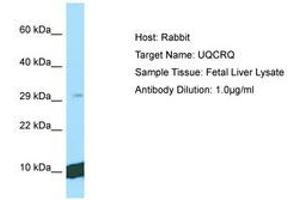 Image no. 1 for anti-Ubiquinol-Cytochrome C Reductase, Complex III Subunit VII, 9.5kDa (UQCRQ) (C-Term) antibody (ABIN6750145)