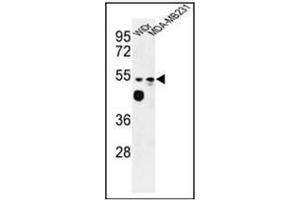 Western blot analysis of Tricellulin Antibody (C-term) in WiDr, MDA-MB231 cell line lysates (35ug/lane). (Tricellulin 抗体  (C-Term))