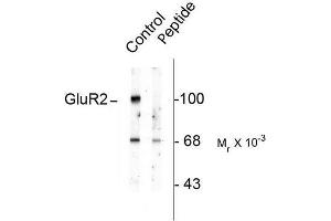 Image no. 1 for anti-Glutamate Receptor, Ionotropic, AMPA 2 (GRIA2) (pSer880) antibody (ABIN372656) (GRIA2 抗体  (pSer880))