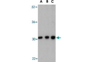 Western blot analysis of BCAP31 in Ramos cell lysate with BCAP31 polyclonal antibody  at (A) 0. (BCAP31 抗体  (C-Term))
