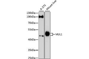 Western blot analysis of extracts of various cell lines, using MUL1 antibody (ABIN6133239, ABIN6144199, ABIN6144200 and ABIN6217001) at 1:3000 dilution. (MUL1 抗体  (AA 1-352))