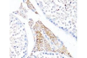 Immunohistochemistry of paraffin-embedded Mouse testis leydig using Fibronectin Polyclonal Antibody at dilution of 1:100 (40x lens). (Fibronectin 抗体)