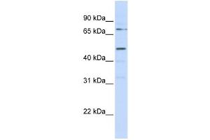 Western Blotting (WB) image for anti-Kringle Containing Transmembrane Protein 1 (KREMEN1) antibody (ABIN2458904) (KREMEN1 抗体)