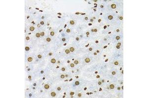 Immunohistochemistry (Paraffin-embedded Sections) (IHC (p)) image for anti-KH Domain Containing, RNA Binding, Signal Transduction Associated 1 (KHDRBS1) (C-Term) antibody (ABIN6142829)