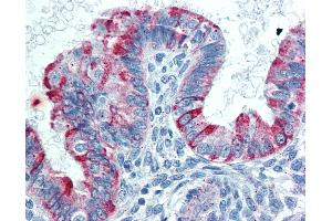 Anti-TNFRSF14 / CD270 antibody IHC of human uterus. (HVEM 抗体  (AA 38-284))