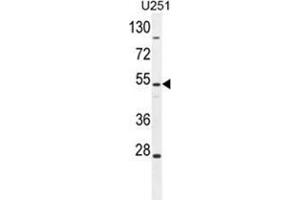 ZIK1 Antibody (Center) western blot analysis in U251 cell line lysates (35 µg/lane). (ZIK1 抗体  (Middle Region))