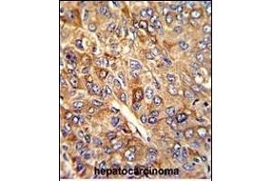 Immunohistochemistry (Paraffin-embedded Sections) (IHC (p)) image for anti-Ferritin, Heavy Polypeptide 1 (FTH1) (AA 154-183), (C-Term) antibody (ABIN390873)