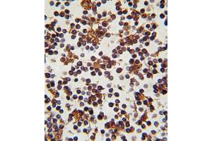 Formalin-fixed and paraffin-embedded human lymph tissue reacted with FOXP3 antibody (C-term), which was peroxidase-conjugated to the secondary antibody, followed by DAB staining. (FOXP3 抗体  (C-Term))