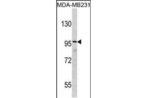 Western blot analysis of DLGAP1 Antibody in MDA-MB231 cell line lysates (35ug/lane) (DLGAP1 抗体  (N-Term))