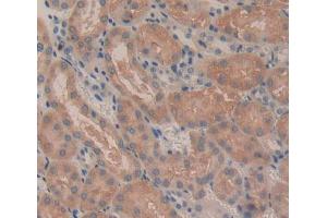 Used in DAB staining on fromalin fixed paraffin- embedded Kidney tissue (CROT 抗体  (AA 410-612))