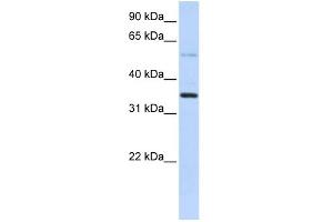 WB Suggested Anti-ANKRD9 Antibody Titration: 0. (ANKRD9 抗体  (Middle Region))