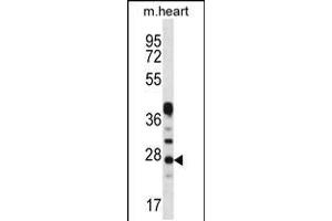 Western blot analysis in mouse heart tissue lysates (35ug/lane). (CRYBA1 抗体  (AA 104-133))