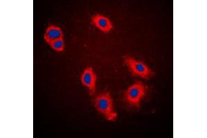 Immunofluorescent analysis of Cytokeratin 18 (pS33) staining in A431 cells. (Cytokeratin 18 抗体  (N-Term, pSer33))