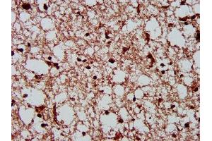 IHC image of ABIN7146885 diluted at 1:300 and staining in paraffin-embedded human brain tissue performed on a Leica BondTM system. (CSNK2A1/CK II alpha 抗体  (AA 1-391))