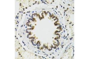 Immunohistochemistry of paraffin-embedded rat lung using RUVBL2 antibody. (RUVBL2 抗体  (AA 1-463))