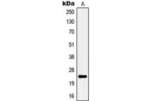 Western Blotting (WB) image for anti-Potassium Large Conductance Calcium-Activated Channel, Subfamily M, beta Member 4 (KCNMB4) (Center) antibody (ABIN7298082)