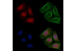 ABIN6255365 and ABIN6267475 staining Hela cells(20 min of 30uM Forskolin treatment) by IF/ICC. (AKT2 抗体  (pSer474))