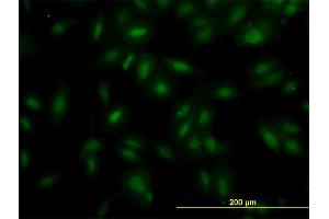 Immunofluorescence of monoclonal antibody to MAK on HeLa cell. (MAK 抗体  (AA 358-457))