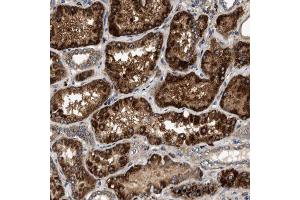 Immunohistochemical staining (Formalin-fixed paraffin-embedded sections) of human kidney using DUSP10 polyclonal antibody  shows strong cytoplasmic positivity with granular pattern in renal tubules. (DUSP10 抗体  (AA 180-291))