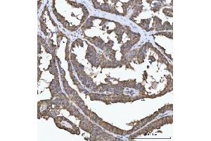 IHC analysis of FADS1 using anti-FADS1 antibody (ABIN7599175). (FADS1 抗体  (AA 1-257))