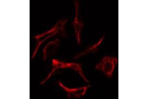 ABIN6269254 staining Hela cells by IF/ICC. (ZAP70 抗体  (Internal Region))