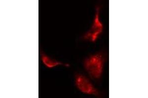 ABIN6275550 staining  HuvEc cells by IF/ICC. (PPP2R3C 抗体  (C-Term))