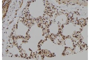 ABIN6276706 at 1/100 staining Rat lung tissue by IHC-P. (Caspase 7 抗体  (N-Term))