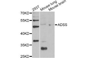 Western blot analysis of extracts of various cell lines, using ADSS Antibody (ABIN6292806) at 1:1000 dilution. (ADSS 抗体)