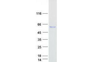 Western Blotting (WB) image for TELO2 Interacting Protein 2 (TTI2) (Transcript Variant 2) protein (Myc-DYKDDDDK Tag) (ABIN2734512)