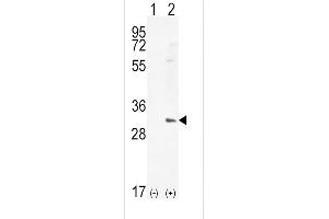Western blot analysis of HMOX1 (arrow) using rabbit polyclonal HMOX1 Antibody (Center) (ABIN655187 and ABIN2844803). (HMOX1 抗体  (AA 177-204))
