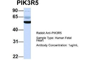 Western Blotting (WB) image for anti-Phosphoinositide-3-Kinase, Regulatory Subunit 5 (PIK3R5) (N-Term) antibody (ABIN2786003)
