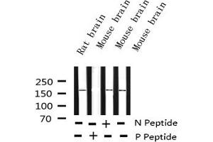 Western blot analysis of Phospho-Ret (Tyr1062) expression in various lysates (Ret Proto-Oncogene 抗体  (pTyr1062))