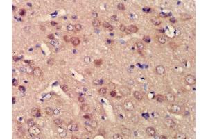 Formalin-fixed and paraffin embedded rat brain labeled with Rabbit Anti-BPTF/FALZ Polyclonal Antibody, Unconjugated (ABIN1386560) at 1:200 followed by conjugation to the secondary antibody and DAB staining (BPTF 抗体  (AA 2801-3046))