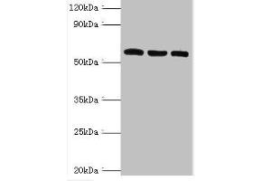 Western blot All lanes: Thioredoxin reductase 2, mitochondrial antibody at 6 μg/mL Lane 1: Mouse liver tissue Lane 2: Mouse gonad tissue Lane 3: Hela whole cell lysate Secondary Goat polyclonal to rabbit IgG at 1/10000 dilution Predicted band size: 57, 54, 47, 31 kDa Observed band size: 57 kDa (TXNRD2 抗体  (AA 100-310))