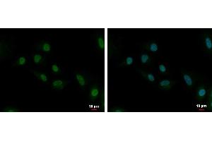 ICC/IF Image UBE2C antibody [N1C3] detects UBE2C protein at cytoplasm and nucleus by immunofluorescent analysis. (UBE2C 抗体)