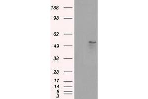Western Blotting (WB) image for anti-Solute Carrier Family 2 (Facilitated Glucose/fructose Transporter), Member 5 (SLC2A5) antibody (ABIN1498475) (SLC2A5 抗体)