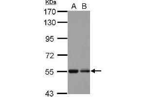 WB Image Sample (30 ug of whole cell lysate) A: U87-MG B: SK-N-SH 7. (KBTBD4 抗体  (Center))