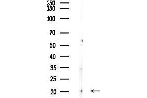 Western blot analysis of lysates from COLO205 cells(UV,30 min treatment), using GPM6B Antibody at 1/1000 dilution.