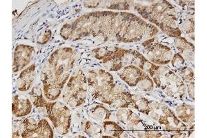 Immunoperoxidase of monoclonal antibody to PVRL3 on formalin-fixed paraffin-embedded human stomach. (nectin-3 抗体  (AA 59-166))