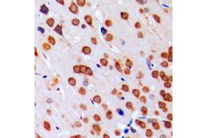 Immunohistochemistry (IHC) image for anti-COP9 Constitutive Photomorphogenic Homolog Subunit 5 (Arabidopsis) (COPS5) (Center) antibody (ABIN7297862)