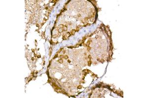 Immunohistochemistry of paraffin-embedded human testis using NY-ESO-1 Rabbit pAb (ABIN6129965, ABIN6139172, ABIN6139173 and ABIN6225112) at dilution of 1:150 (40x lens). (CTAG1B 抗体  (AA 1-180))