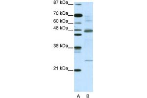 WB Suggested Anti-NFKBIB Antibody Titration:  5. (NFKBIB 抗体  (C-Term))