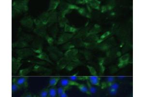 Immunofluorescence (IF) image for anti-Enolase 1 (ENO1) antibody (ABIN7259410)