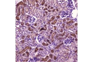 IHC testing of FFPE mouse kidney tissue with PDGFRB antibody at 2 ug/ml. (PDGFRB 抗体  (AA 911-992))