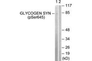 Western blot analysis of extracts from NIH-3T3 cells treated with PMA 125ng/ml 30', using Glycogen Synthase (Phospho-Ser645) Antibody. (Glycogen Synthase 抗体  (pSer645))